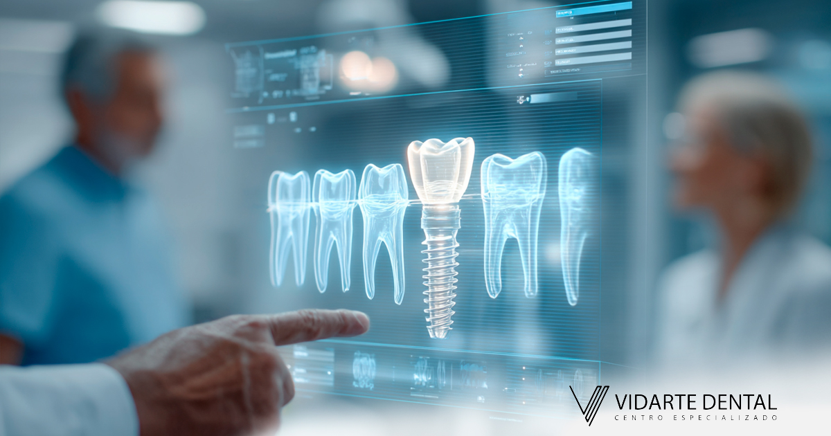 Dolor y Confort de un Implante Dental