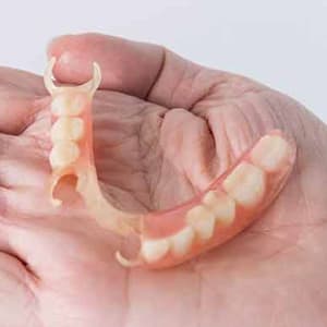 Prótesis dentales en Málaga